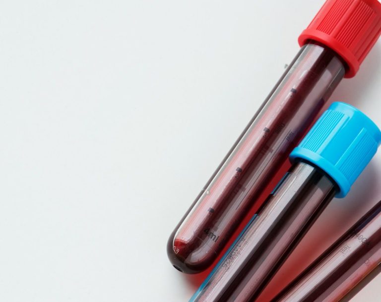 Ich berate und unterstütze dich