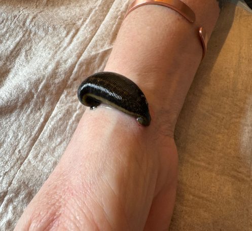 Blutegeltherapie 