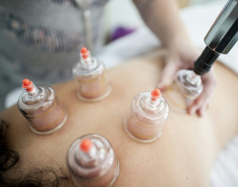 Ich helfe dir zu entspannen und das am besten mit Schröpfen