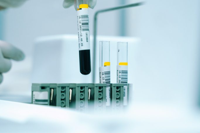 Labordiagnostik